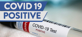 COVID-19 Positive